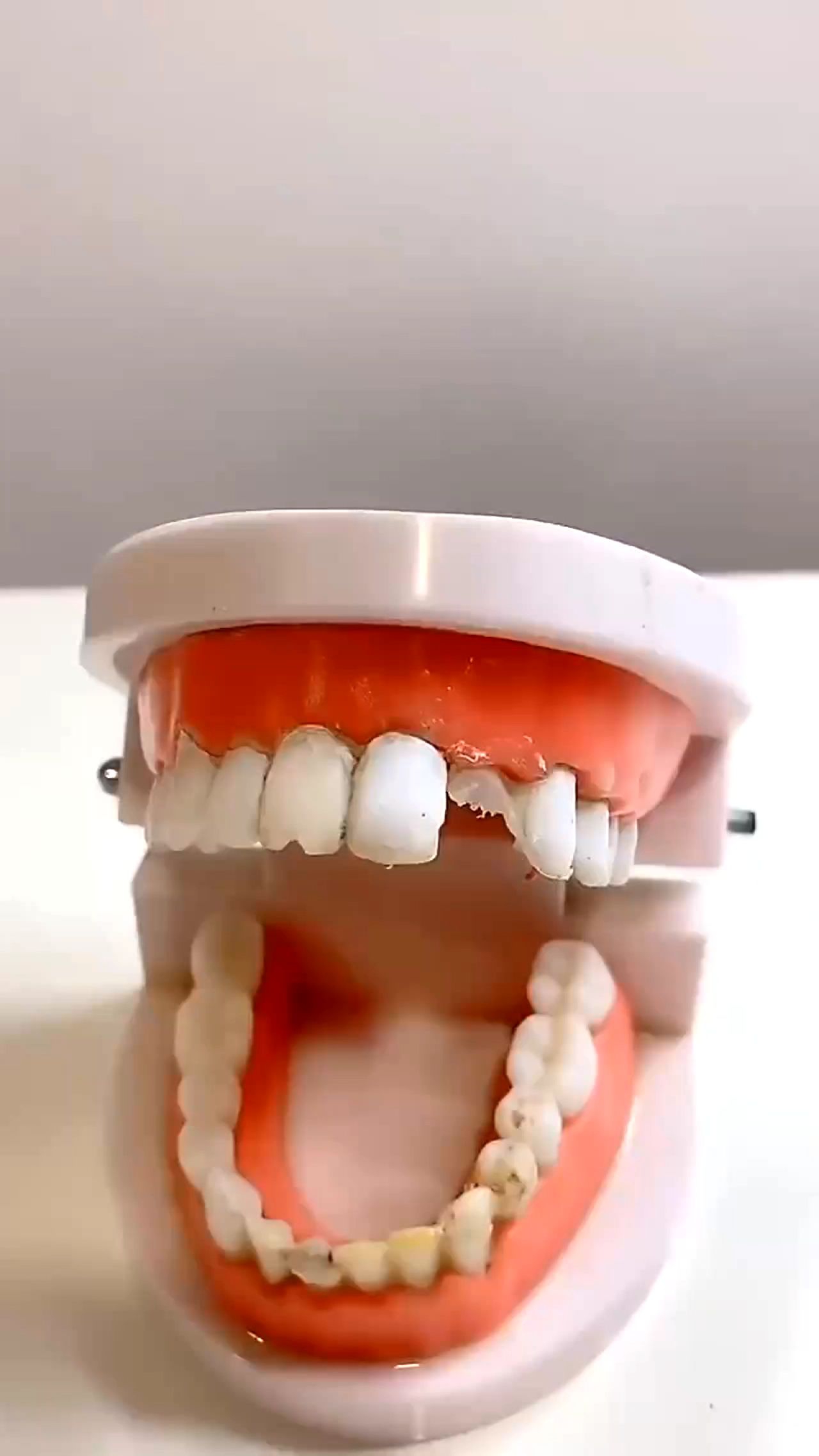 Temporary tooth Repair kit (100/200 Pieces) Moldable Replacement tooth